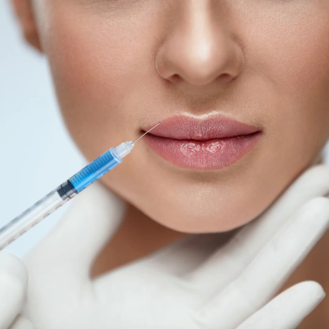 Volumen und Lifting mit restylane lyft – jetzt entdecken