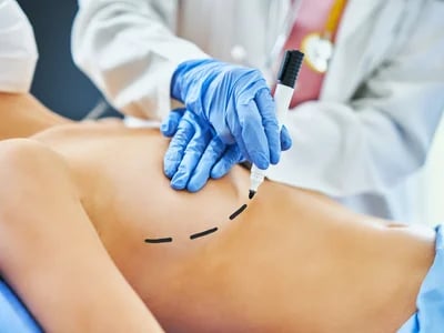 Der innere BH und die Bruststraffung: Ein neues Konzept für langfristige Bruststabilität