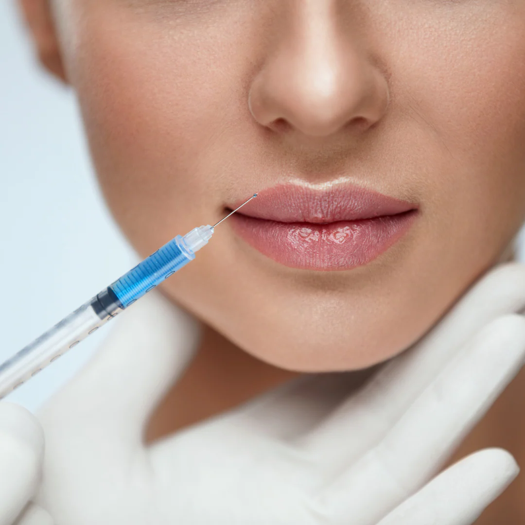 Volumen und Lifting mit restylane lyft – jetzt entdecken