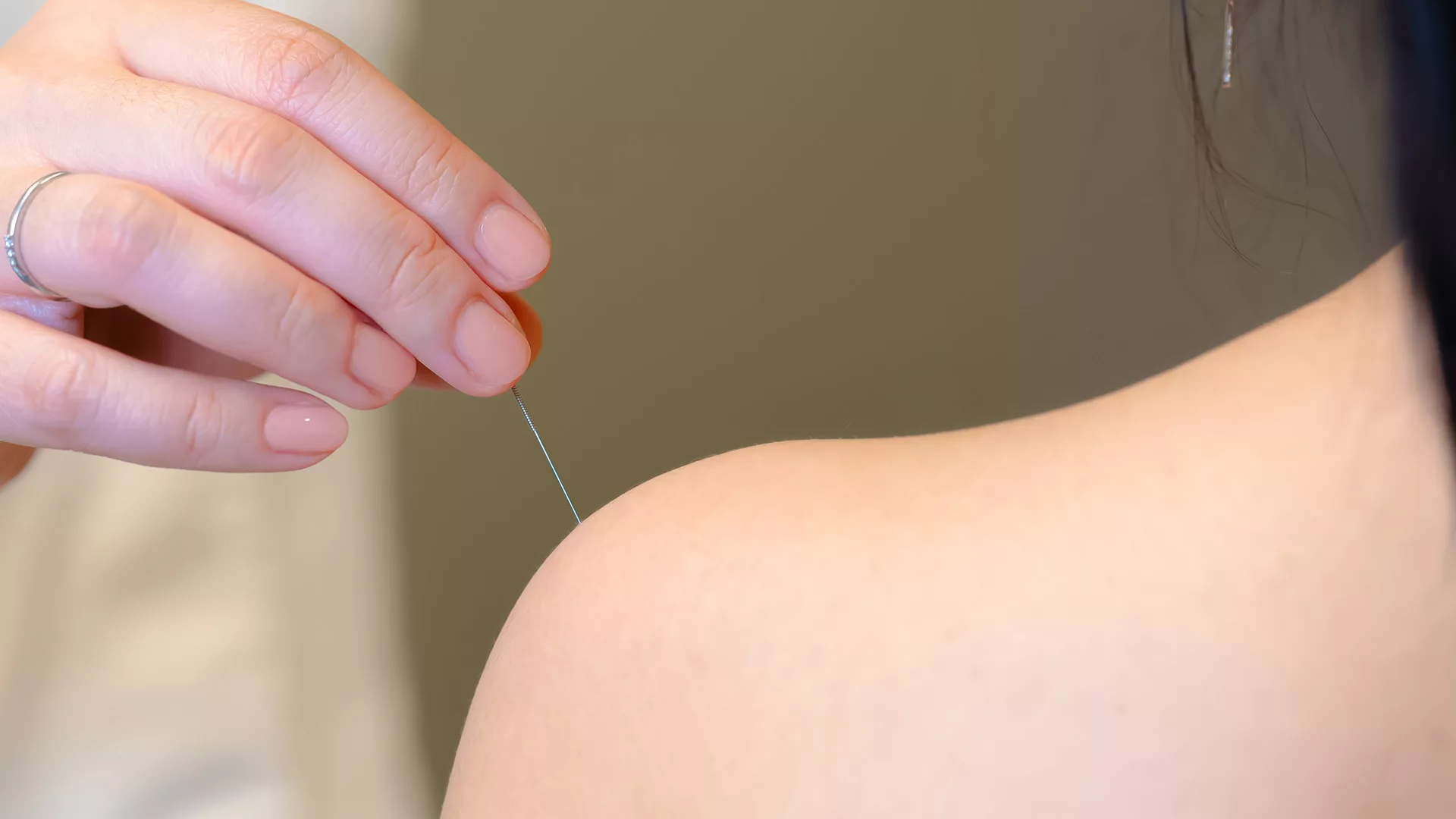 Akupunktura a Qi energia harmonizálásában – Akupunkturbehandlungen usw nézőpontja